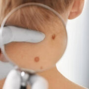 Devenir dermatologue