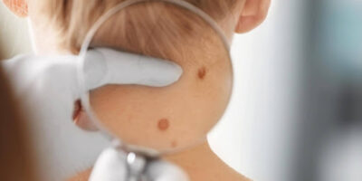 Devenir dermatologue