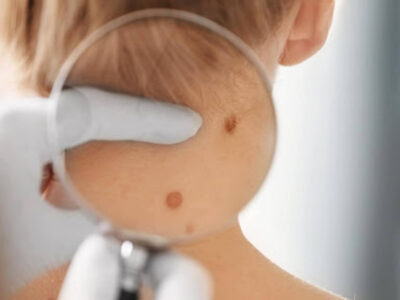 Devenir dermatologue