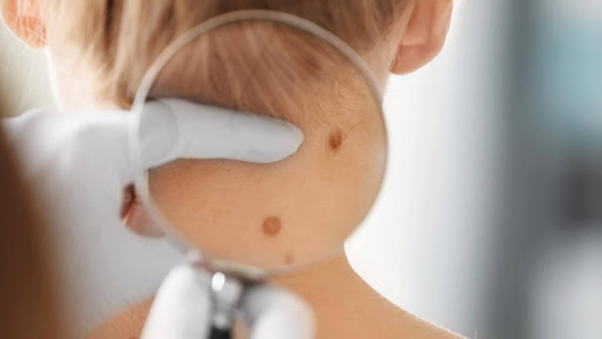 Devenir dermatologue